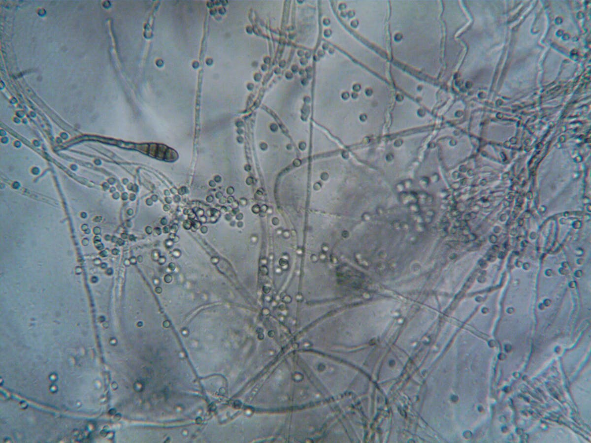 Fungal hyphae and spores under a microscope