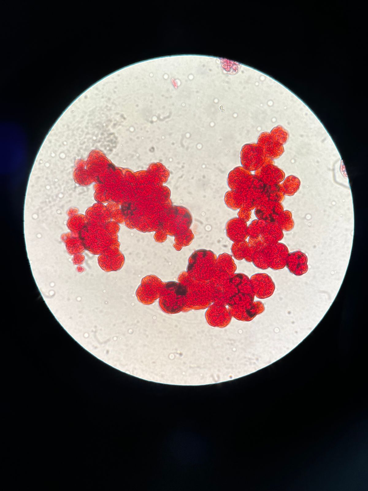 Staphylococcus clusters under a microscope
