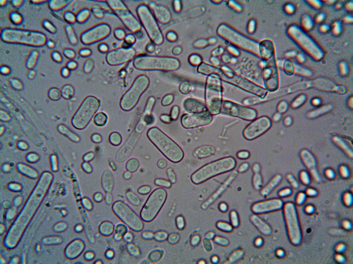Rod-shaped bacteria under a microscope