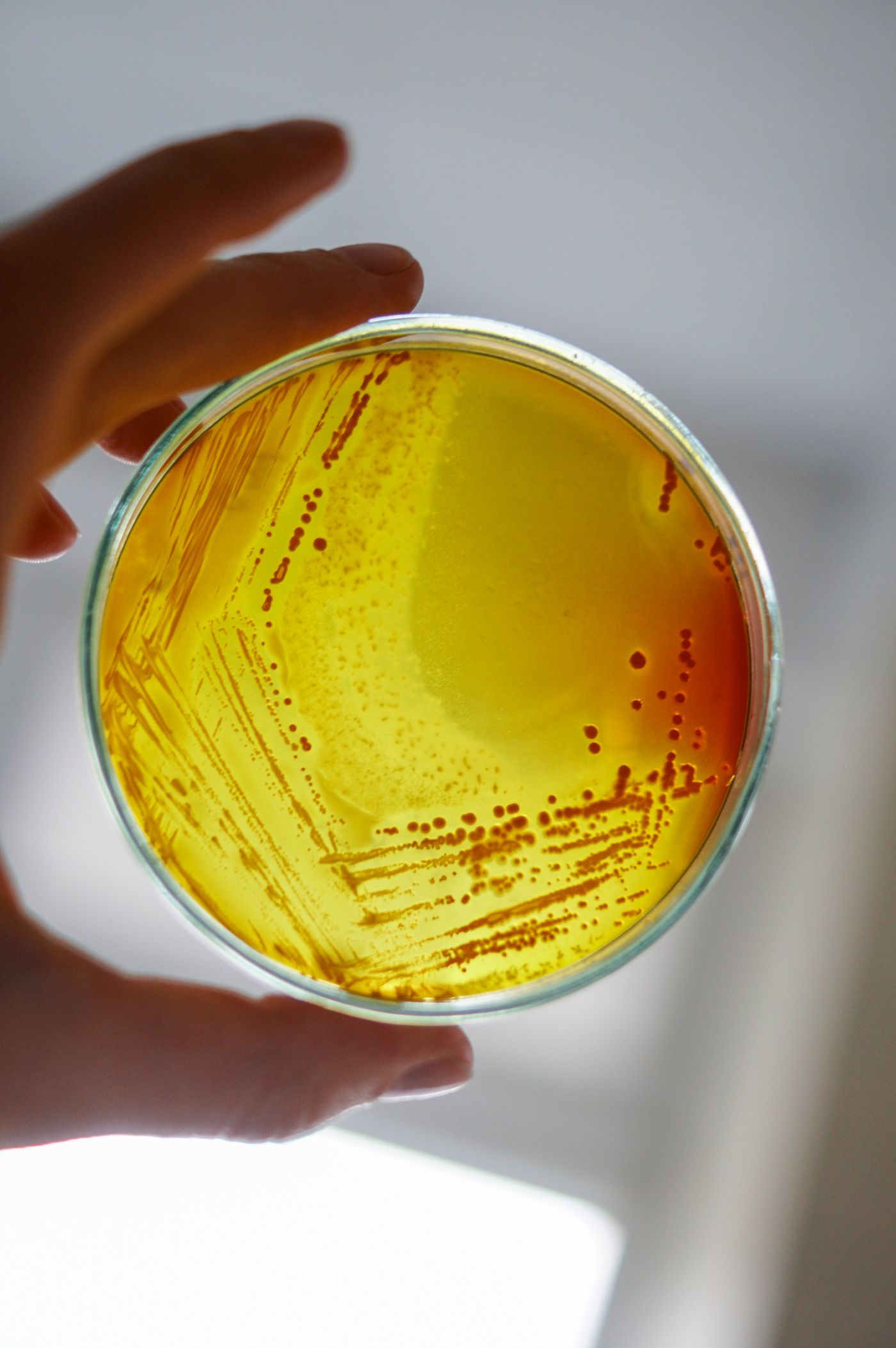 Bacteria cultured from a helmet swab